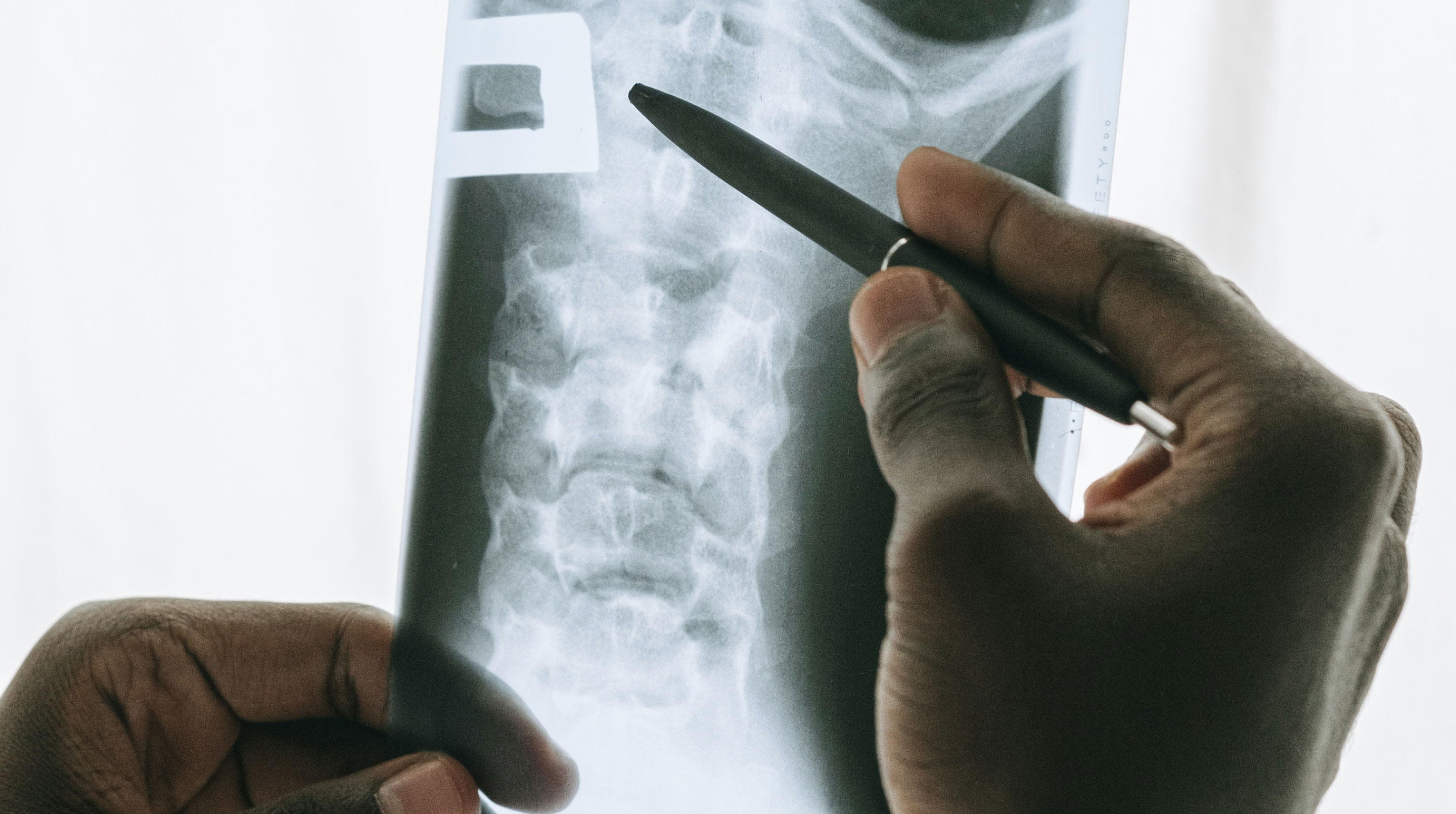 Edge Computing Improves Performance, Reduces Costs and Solves Data Governance Issues for Medical Imaging