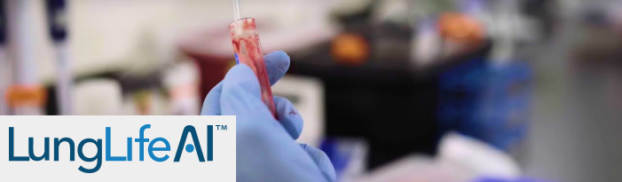 LungLifeAI achieves faster cancer diagnosis with AI & ML