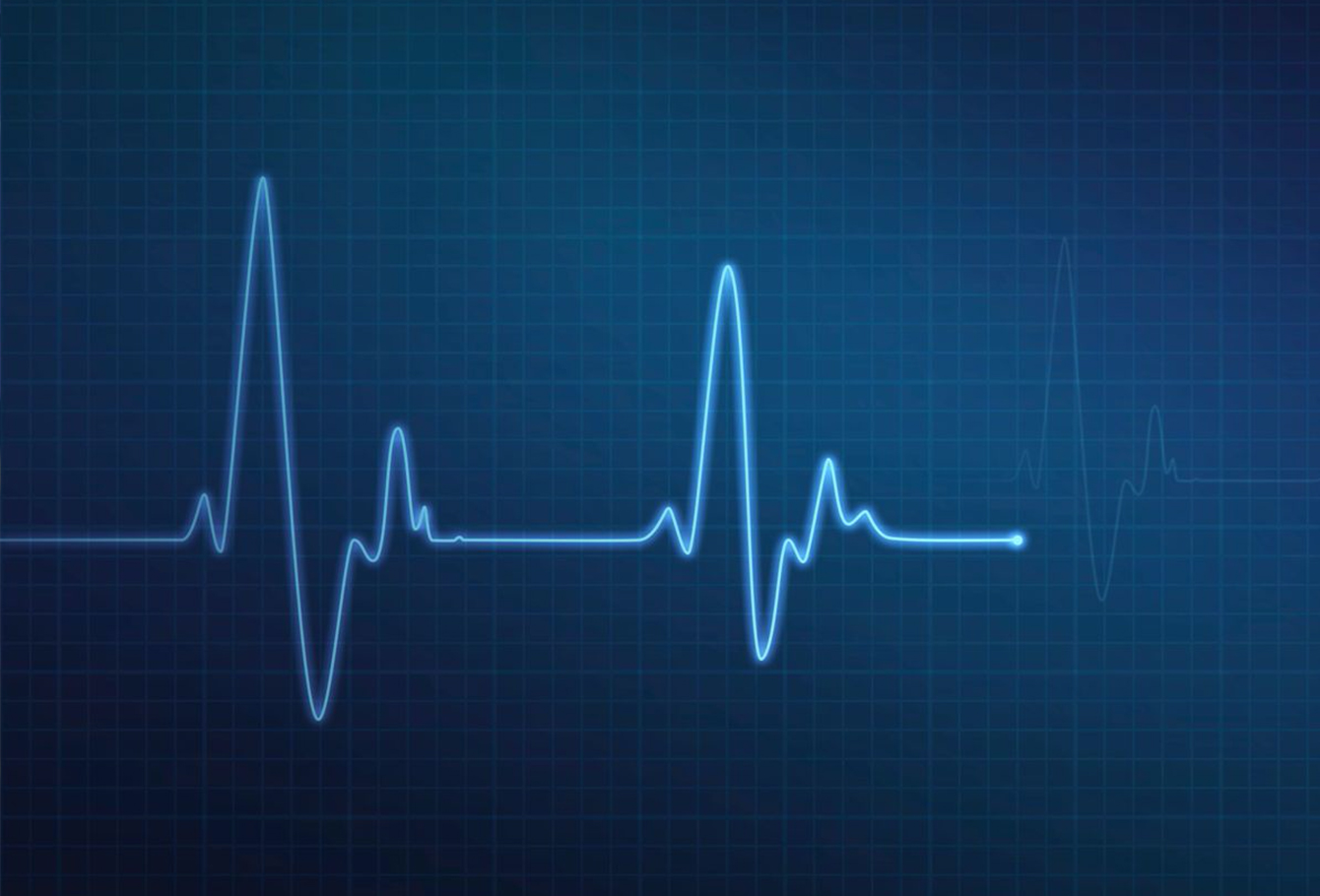 IBM ELM Solutions for the Medical Device Industry