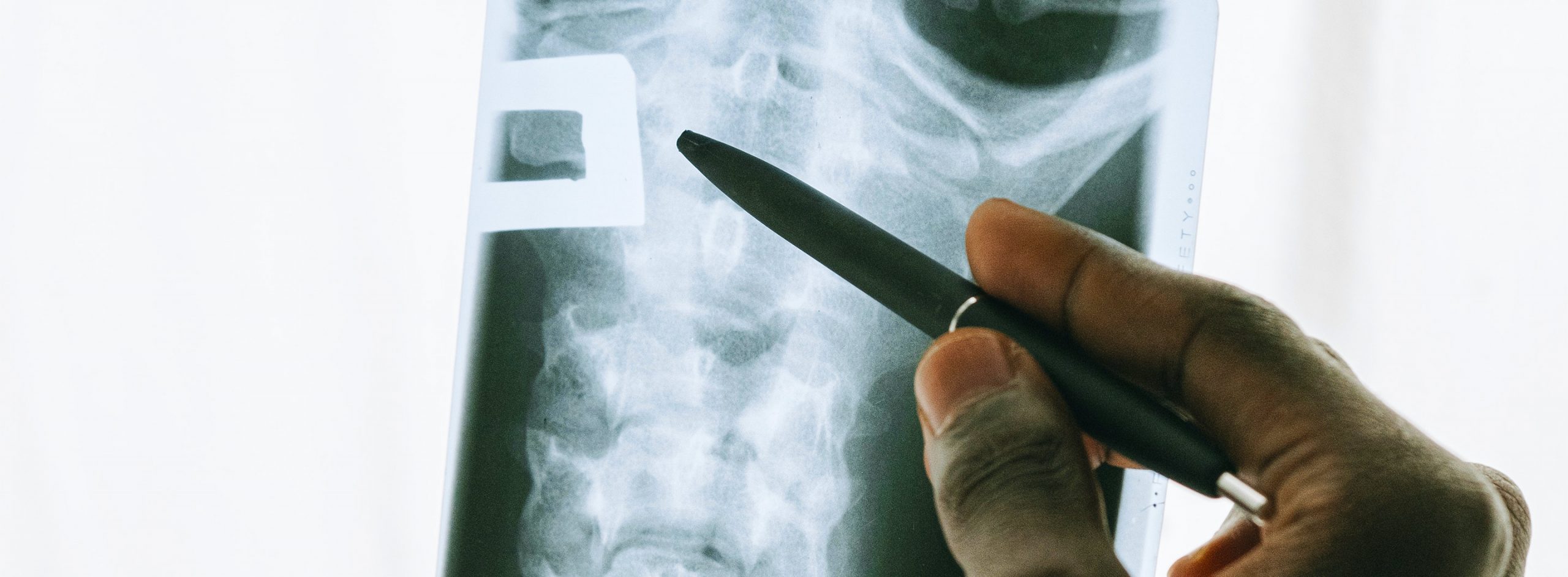 Edge Computing Solves Perf., Costs & Governance Issues for Medical Imaging