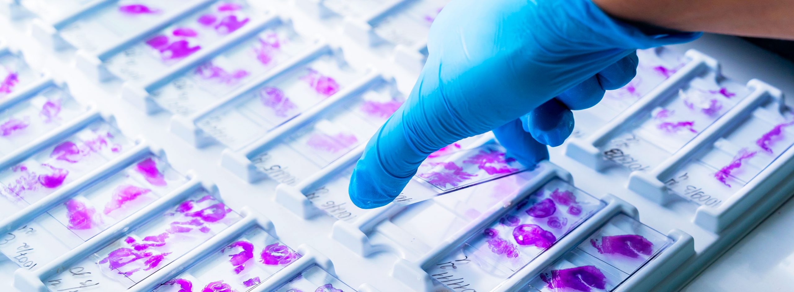 Banner-Making-Patient-centric-Decentralized-Clinical-Trial-scaled